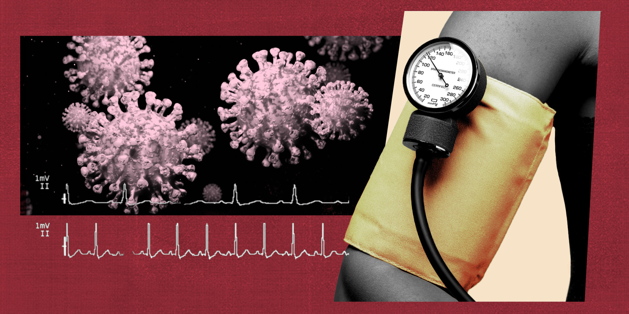 Blood Pressure Rose During The Pandemic, Especially for Women, Study Finds